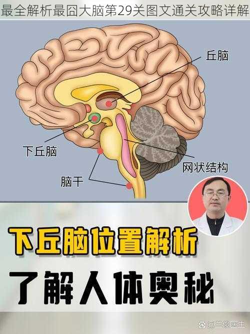 最全解析最囧大脑第29关图文通关攻略详解